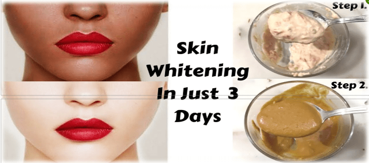 Home Remedy for Skin Whitening in Just 3 Days